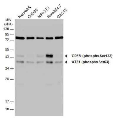 Western Blot: ATF1 [p Ser63] Antibody [NBP3-12920] - Various whole cell extracts (30 ug) were separated by 12% SDS-PAGE, and the membrane was blotted with ATF1 (phospho Ser63) antibody (NBP3-12920) diluted at 1:5000. The HRP-conjugated anti-rabbit IgG antibody (NBP2-19301) was used to detect the primary antibody.